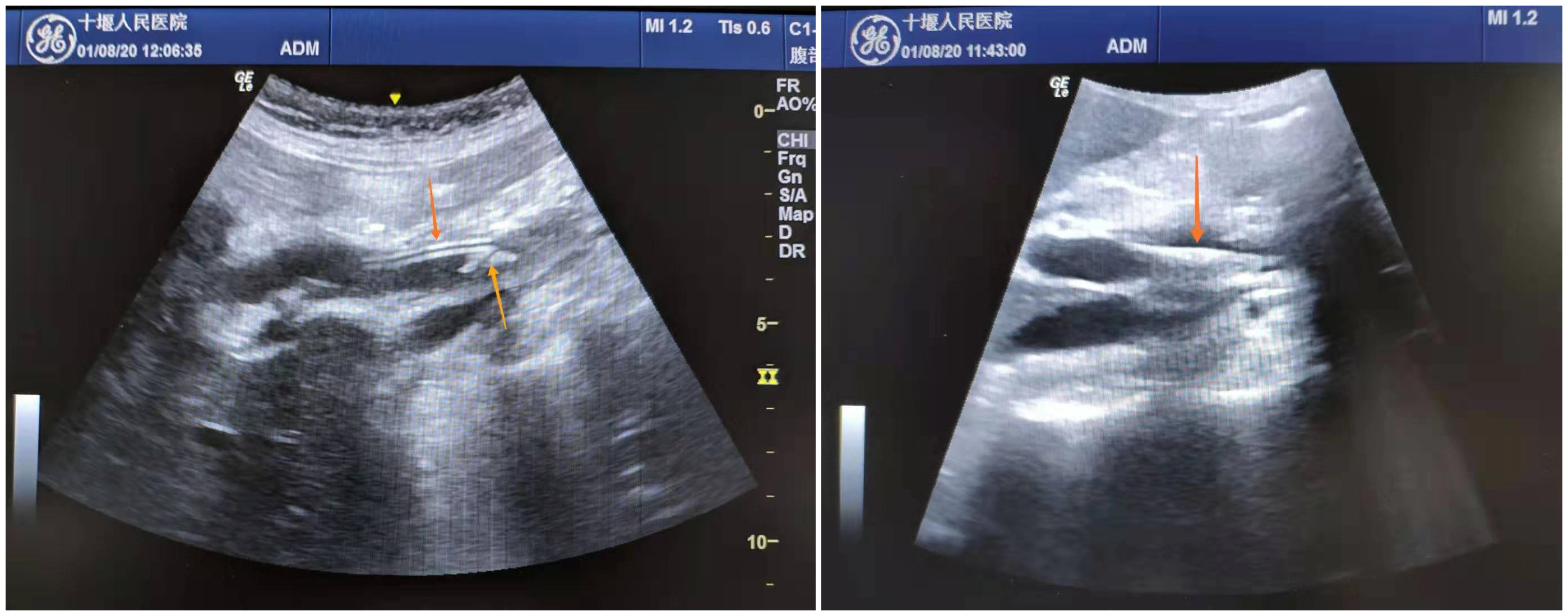 图为超声影像资料