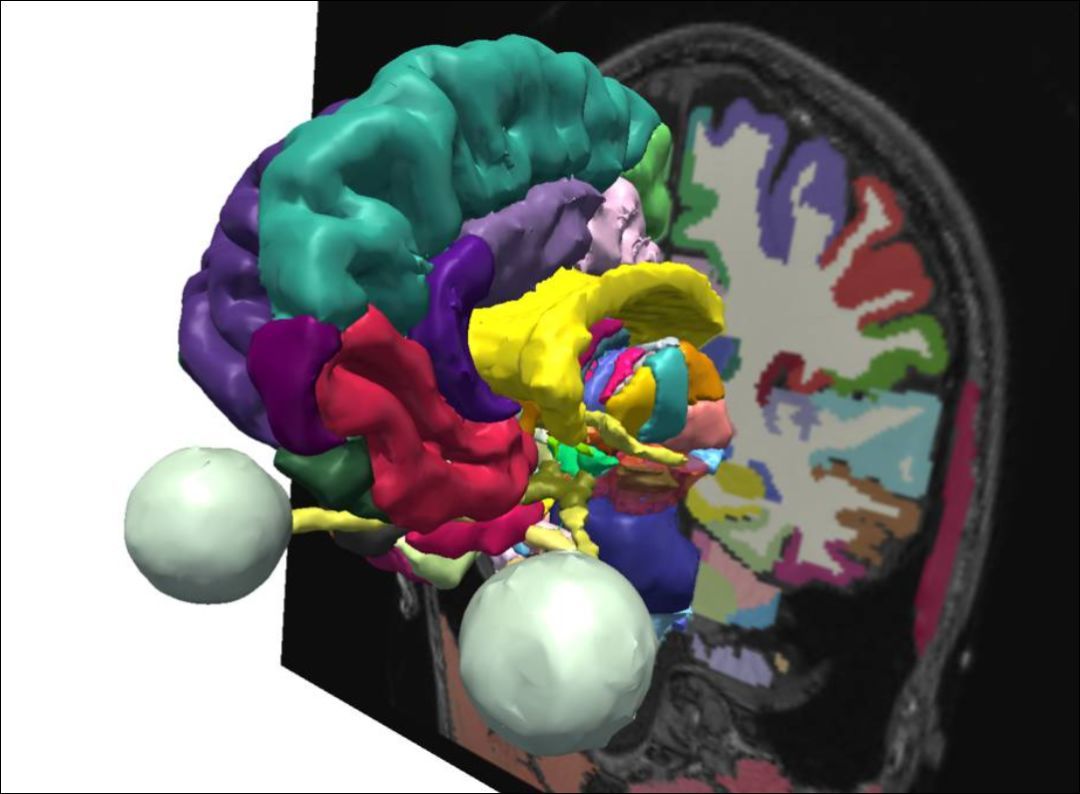 各个脑回及胼胝体,丘脑结构清晰可见,更可以通过立体结构的显示学习