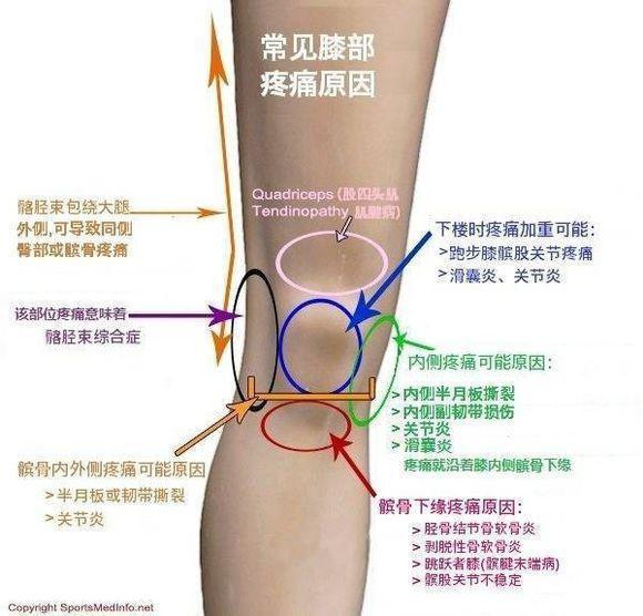 最複雜的關節,由股骨(大腿骨)下端的內,外側髁和脛骨(小腿骨)上端的內