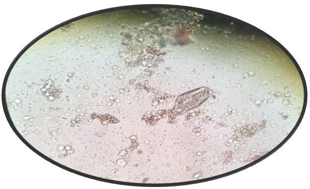 镜检纤毛虫图片
